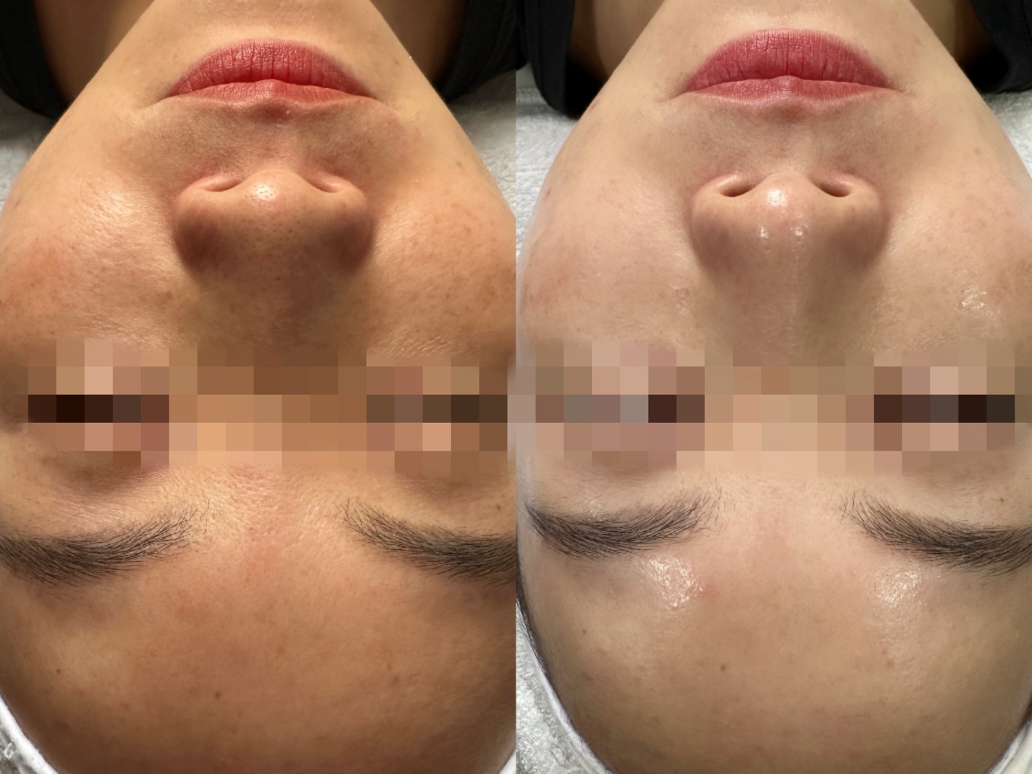 白雪公主 光感嫩肤